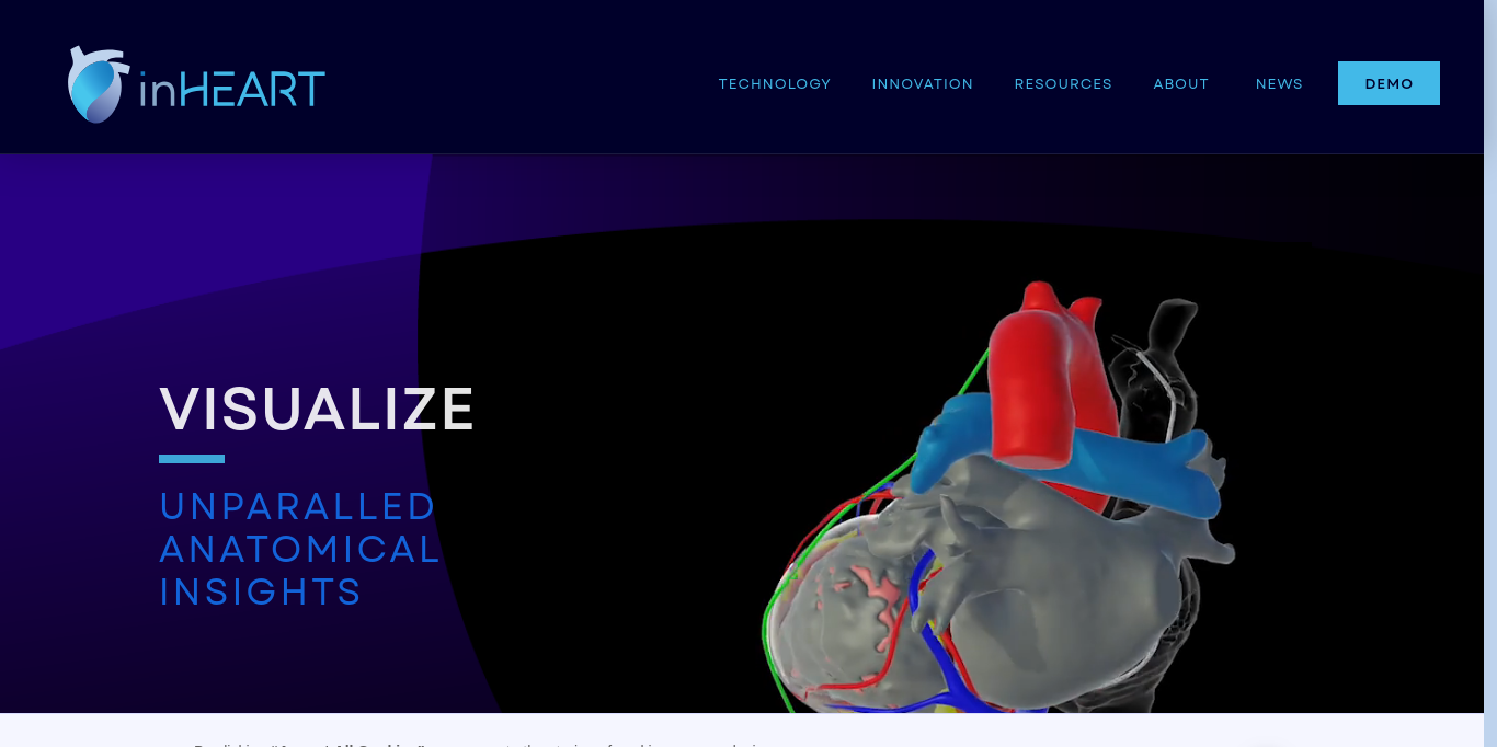https://www.inheartmedical.com/